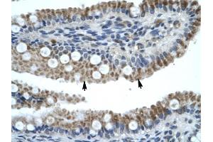 ZNF683 antibody was used for immunohistochemistry at a concentration of 4-8 ug/ml to stain Epithelial cells of intestinal villus {arrows) in Human Intestine. (ZNF683 抗体  (N-Term))