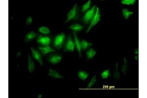 Immunofluorescence of monoclonal antibody to NME2 on HeLa cell. (NME2 抗体  (AA 51-152))