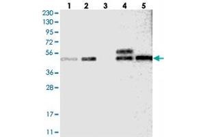 Western blot analysis of Lane 1: RT-4, Lane 2: U-251 MG, Lane 3: Human Plasma, Lane 4: Liver, Lane 5: Tonsil with SLC43A1 polyclonal antibody . (SLC43A1 抗体)