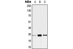 Western blot analysis of ANP32C expression in HeLa (A), SP2/0 (B), H9C2 (C) whole cell lysates. (ANP32C 抗体  (Center))