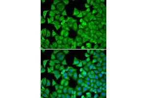 Immunofluorescence analysis of MCF-7 cell using RRM1 antibody. (RRM1 抗体)