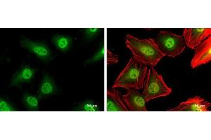 Immunofluorescence (IF) image for anti-Cyclin-Dependent Kinase Inhibitor 1B (p27, Kip1) (CDKN1B) antibody (ABIN2854753)