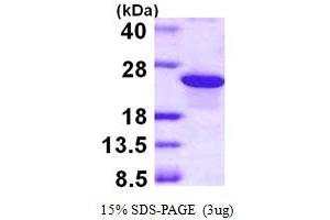 SDS-PAGE (SDS) image for ADP-Ribosylation Factor-Like 5B (ARL5B) (AA 1-179) protein (His tag) (ABIN667512) (ARL5B Protein (AA 1-179) (His tag))