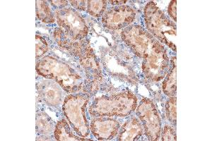 Immunohistochemistry (IHC) image for anti-Translocase of Inner Mitochondrial Membrane 50 Homolog (TIMM50) antibody (ABIN1513120)