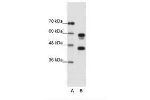 Image no. 1 for anti-Proteasome (Prosome, Macropain) 26S Subunit, ATPase, 5 (PSMC5) (C-Term) antibody (ABIN202447) (PSMC5 抗体  (C-Term))