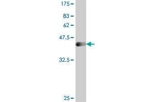 Western Blot detection against Immunogen (36. (SSX4 抗体  (AA 91-188))