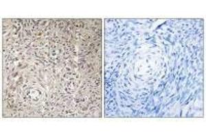 Immunohistochemistry analysis of paraffin-embedded human ovary tissue using GCNT7 antibody. (GCNT7 抗体)