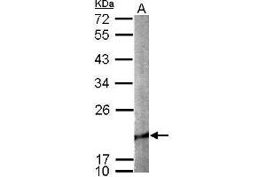 WB Image Sample (50 ug of whole cell lysate) A: mouse brain 12% SDS PAGE antibody diluted at 1:1000 (Cofilin 2 抗体)