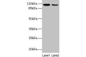 Western blot All lanes: ATP2A2 antibody at 6 μg/mL Lane 1: Mouse heart tissue Lane 2: Mouse skeletal muscle tissue Secondary Goat polyclonal to rabbit IgG at 1/10000 dilution Predicted band size: 115, 110, 112 kDa Observed band size: 115 kDa (ATP2A2 抗体  (AA 314-756))