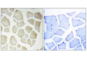 Immunohistochemistry analysis of paraffin-embedded human skeletal muscle tissue, using CDKL3 antibody. (CDKL3 抗体  (Internal Region))