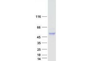 Western Blotting (WB) image for CCR4-NOT Transcription Complex, Subunit 11 (CNOT11) protein (Myc-DYKDDDDK Tag) (ABIN2715497)