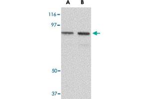 Western blot analysis of NUP107 in A-549 cell lysate with NUP107 polyclonal antibody  at (A) 1 and (B) 2 ug/mL . (NUP107 抗体  (C-Term))