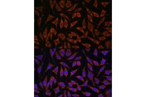 Immunofluorescence analysis of L929 cells using PASK antibody (ABIN6128413, ABIN6145248, ABIN6145249 and ABIN6224850) at dilution of 1:100.