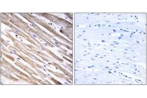 Immunohistochemistry analysis of paraffin-embedded human heart tissue, using RPL3L Antibody. (RPL3L 抗体  (AA 211-260))