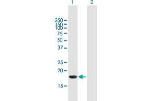 Western Blot analysis of ALG13 expression in transfected 293T cell line by ALG13 MaxPab polyclonal antibody. (ALG13 抗体  (AA 1-165))