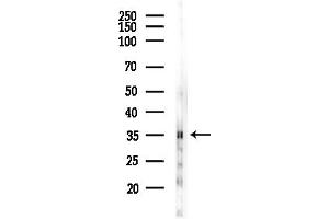 anti-Fc gamma RII (CD32) (C-Term) antibody