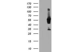 Western Blotting (WB) image for anti-N-Myristoyltransferase 2 (NMT2) antibody (ABIN1499782) (NMT2 抗体)