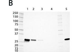 Expression analysis of rat GSTs of the mu and alpha classes. (GSTM4 抗体  (AA 21-215))