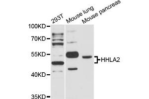 Western blot analysis of extracts of various cell lines, using HHLA2 antibody (ABIN6293271) at 1:3000 dilution. (HHLA2 抗体)