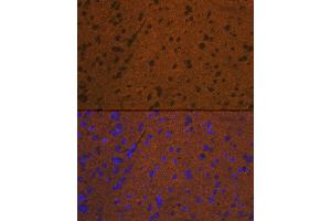 Immunofluorescence analysis of mouse brain cells using Syntaxin Rabbit mAb (ABIN7270685) at dilution of 1:100 (40x lens).