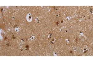 Immunohistochemistry of paraffin-embedded Human brain tissue using MTBP Polyclonal Antibody at dilution 1:40 (MTBP 抗体)