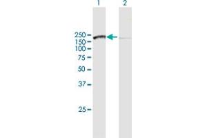 Western Blot analysis of SMC3 expression in transfected 293T cell line by SMC3 MaxPab polyclonal antibody. (SMC3 抗体  (AA 1-1217))