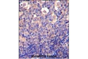 Immunohistochemistry (Paraffin-embedded Sections) (IHC (p)) image for anti-Killer Cell Lectin-Like Receptor Subfamily C, Member 2 (KLRC2) (AA 1-30), (N-Term) antibody (ABIN652570)