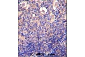 KLRC2 Antibody (N-term) (ABIN652570 and ABIN2842383) immunohistochemistry analysis in formalin fixed and paraffin embedded human tonsillitis tissue followed by peroxidase conjugation of the secondary antibody and DAB staining. (KLRC2 抗体  (N-Term))