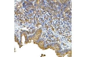 Immunohistochemistry of paraffin-embedded rat lung using IFIH1 Rabbit pAb (ABIN6131879, ABIN6142174, ABIN6142175 and ABIN6217724) at dilution of 1:50 (40x lens).