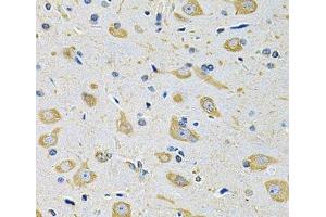 Immunohistochemistry of paraffin-embedded Mouse brain using FASTKD1 Polyclonal Antibody at dilution of 1:100 (40x lens). (FASTKD1 抗体)