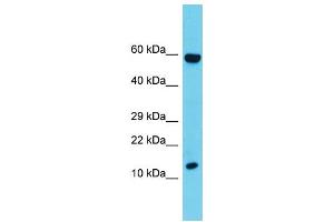 Host: Rabbit  Target Name: Cd247  Sample Tissue: Rat Thymus lysates  Antibody Dilution: 1. (CD247 抗体  (C-Term))