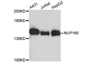 Western blot analysis of extracts of various cell lines, using NUP160 antibody. (NUP160 抗体  (AA 40-150))