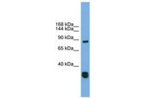 Image no. 1 for anti-Follistatin-Like 5 (FSTL5) (C-Term) antibody (ABIN6744178) (FSTL5 抗体  (C-Term))