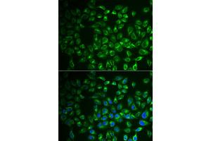 Immunofluorescence analysis of A549 cell using FABP6 antibody. (FABP6 抗体)