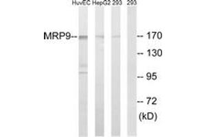 Western blot analysis of extracts from 293/HepG2/HuvEc cells, using MRP9 Antibody. (ABCC12 抗体  (AA 691-740))
