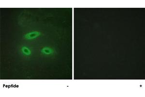 Immunofluorescence analysis of HeLa cells, using NKTR polyclonal antibody . (NKTR 抗体)