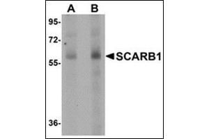 Western blot analysis of SCARB1 in human spleen tissue lysate with this product at (A) 1 and (B) 2 μg/ml.