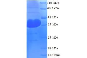 Argonaute 2 (AGO2) (AA 517-818) protein (His tag)