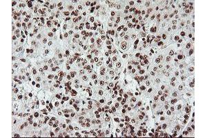 Image no. 5 for anti-Exosome Component 7 (EXOSC7) antibody (ABIN1498140)
