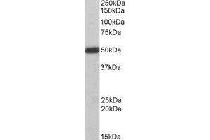 Image no. 2 for anti-C-Src tyrosine Kinase (CSK) (C-Term) antibody (ABIN374096) (CSK 抗体  (C-Term))