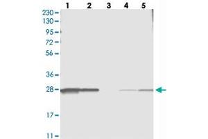 Western blot analysis of Lane 1: RT-4, Lane 2: U-251 MG, Lane 3: Human Plasma, Lane 4: Liver, Lane 5: Tonsil with C11orf73 polyclonal antibody  at 1:250-1:500 dilution. (C11orf73 抗体)