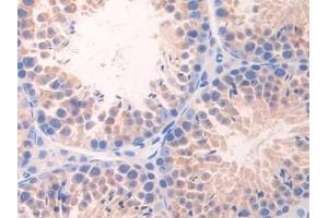 Detection of NCAD in Mouse Testis Tissue using Polyclonal Antibody to N-cadherin (NCAD) (N-Cadherin 抗体  (AA 45-238))