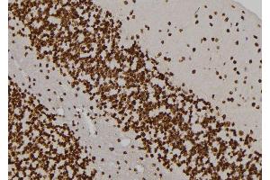 ABIN6276995 at 1/100 staining Rat brain tissue by IHC-P. (MVP 抗体  (N-Term))