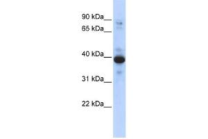 WB Suggested Anti-RNF34 Antibody Titration:  0. (RNF34 抗体  (Middle Region))
