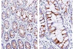Immunohistochemical staining (Formalin-fixed paraffin-embedded sections) analysis of human small intestine with ECM1 monoclonal antibody, clone SC05  at 1:500 using peroxidase-conjugate and DAB chromogen (Note: cytoplasmic and membrane staining). (ECM1 抗体)