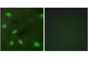 Immunofluorescence analysis of HeLa cells, using GIRK1/KIR3. (KCNJ3 抗体  (pSer185))