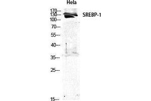 Western Blotting (WB) image for anti-Sterol Regulatory Element Binding Transcription Factor 1 (SREBF1) (Tyr1175) antibody (ABIN3177512) (SREBF1 抗体  (Tyr1175))