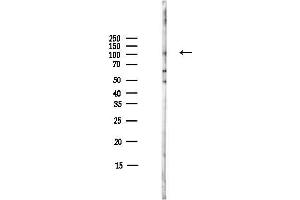 Western blot analysis of lysates from COLO205 cells(heat-shock,45 min treatment), using PDE5A Antibody at 1/1000 dilution.