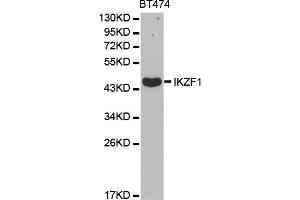 Western blot analysis of extracts of BT-474 cells, using IKZF1 antibody (ABIN5970949) at 1/1000 dilution. (IKZF1 抗体)