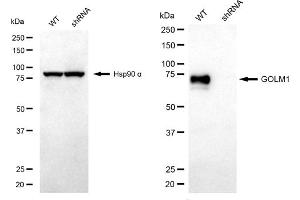 Western blotting analysis using GOLM1 antibody (ABIN7798792). (GOLM1 抗体)